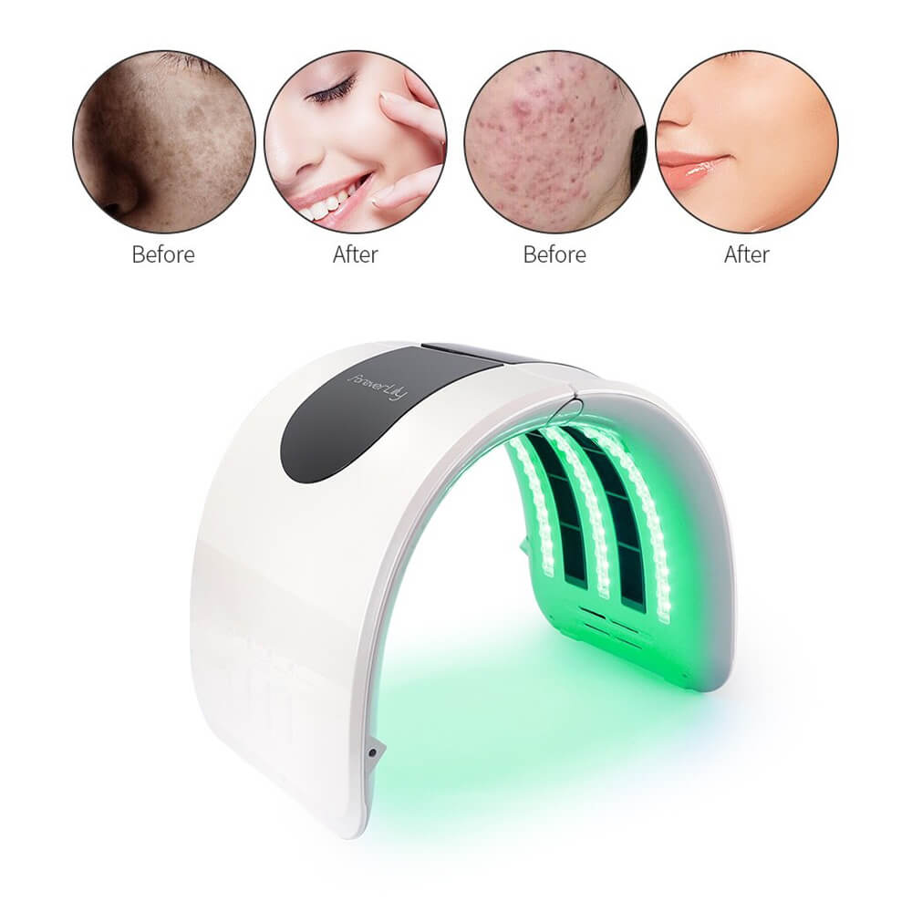 facial-light-therapy-gallery-25012-1 beauty